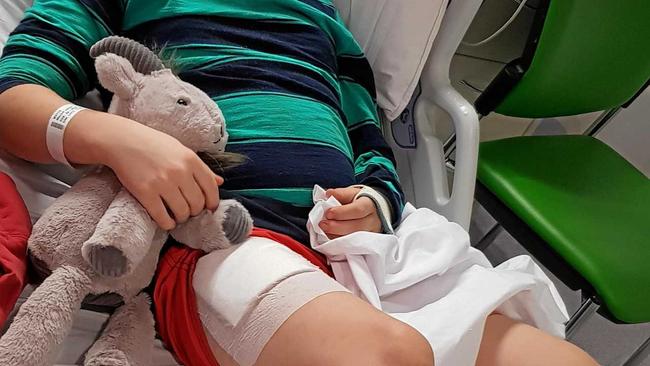 RESTING UP: Mitch Watts is getting some sleep in the Lady Cilento Hopsital where he recently had a skin graft. Picture: Sharon Watts