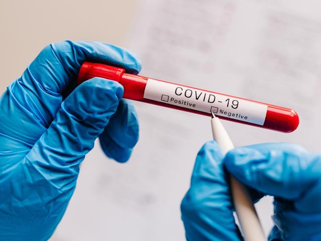 Covid-19 text. A hands of doctor, nurse, scientist writes with a pen and confirms the negative result, hold a test tube with biological sample. Coronavirus. Blood is dont infected. New cases of cure.