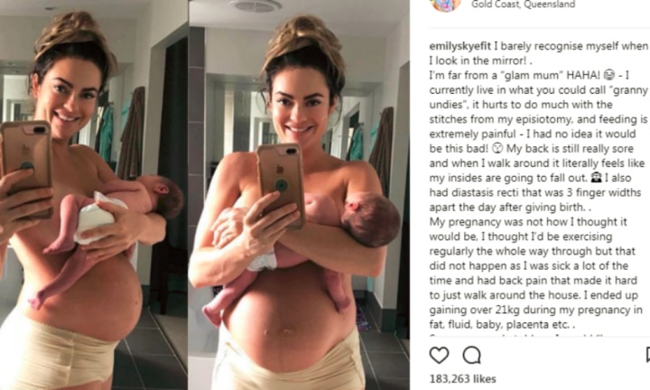 Emily Skye Shares Photo of Her 'Squishy' Postpartum Belly