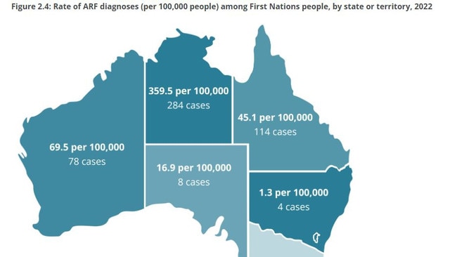 Acute rheumatic fever diagnoses among First Nations people 2022. Picture: AIHW