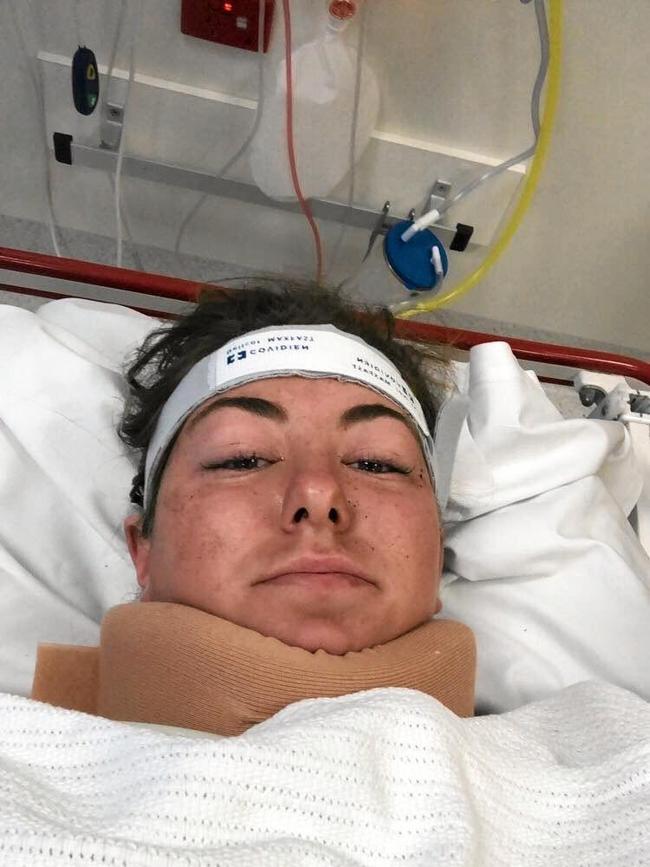 RaeLea Foley after her accident while working as a livestock hand. Picture: Supplied