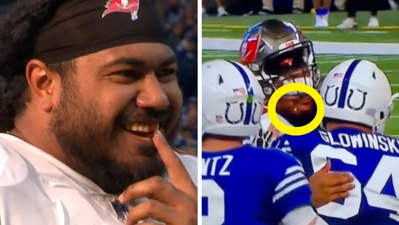 Buccaneers' Vita Vea Loses a Tooth vs. Colts After Taking Helmet to the  Mouth, News, Scores, Highlights, Stats, and Rumors