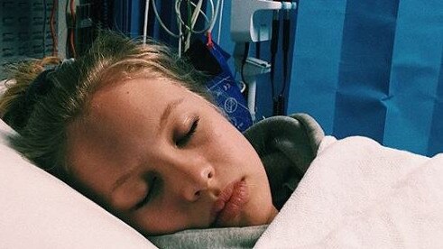 Olivia Deeble made headlines after suffering swelling to her brain when she hit her head.