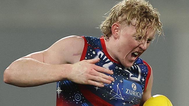 GEELONG, AUSTRALIA - JULY 07: Clayton Oliver of the Demons reacts after he was kicked in the hand during the round 17 AFL match between the Geelong Cats and the Melbourne Demons at GMHBA Stadium on July 07, 2022 in Geelong, Australia. (Photo by Robert Cianflone/Getty Images)
