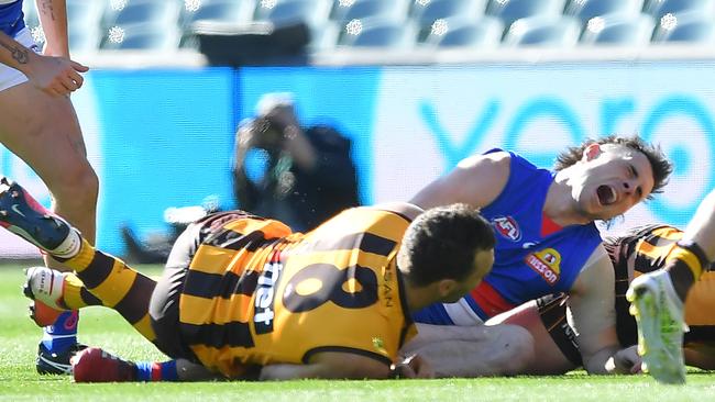 McLean immediately writhed in pain as he came out of the tackle. Picture: Getty Images