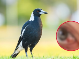 Mum terrified after magpie attacks her eye on walk