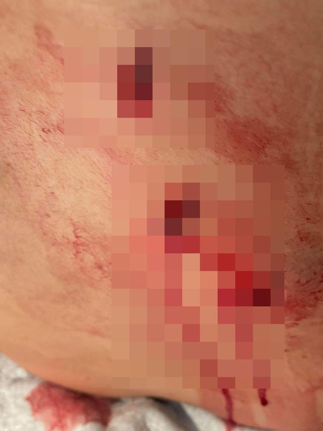 She was allegedly stabbed three times in the back.