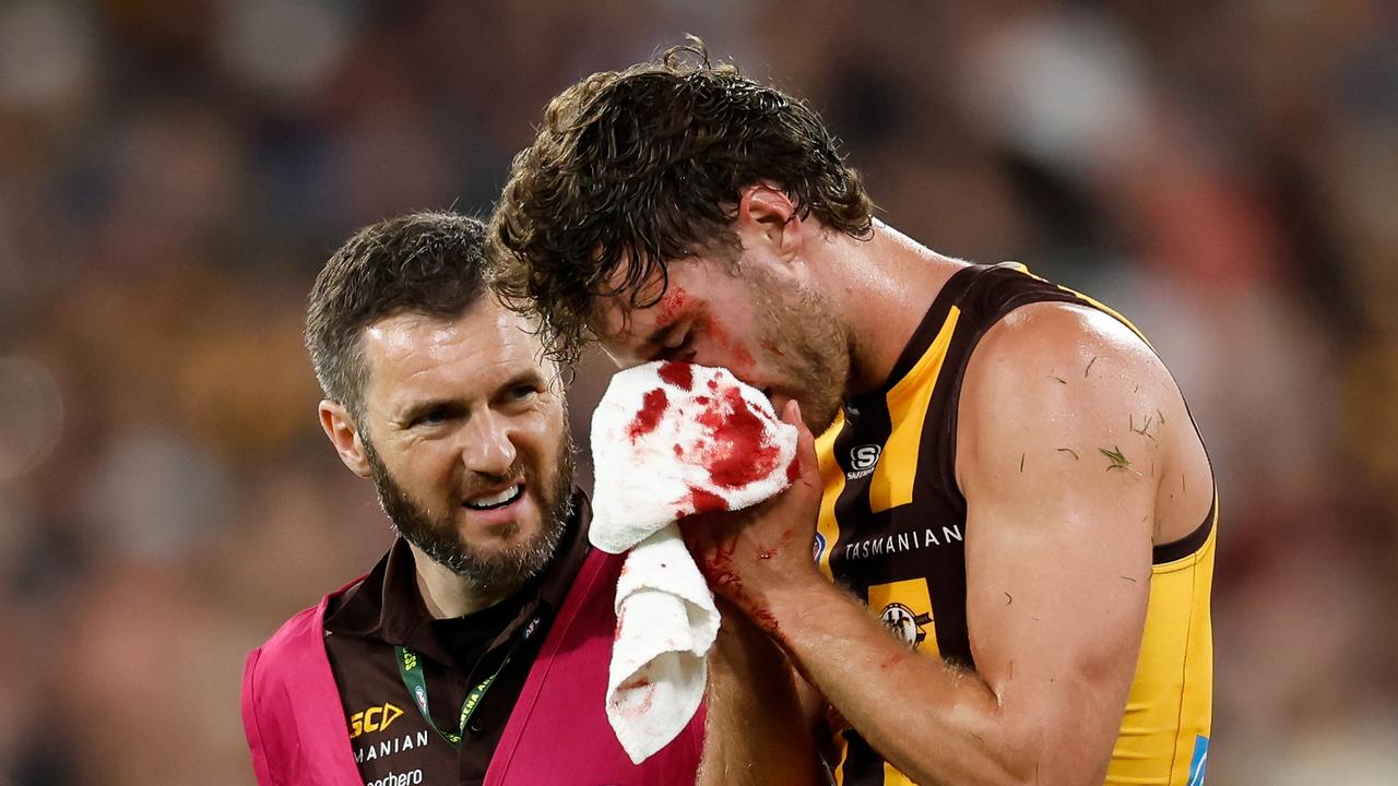 Bloodied Hawk leaves field after brutal head clash