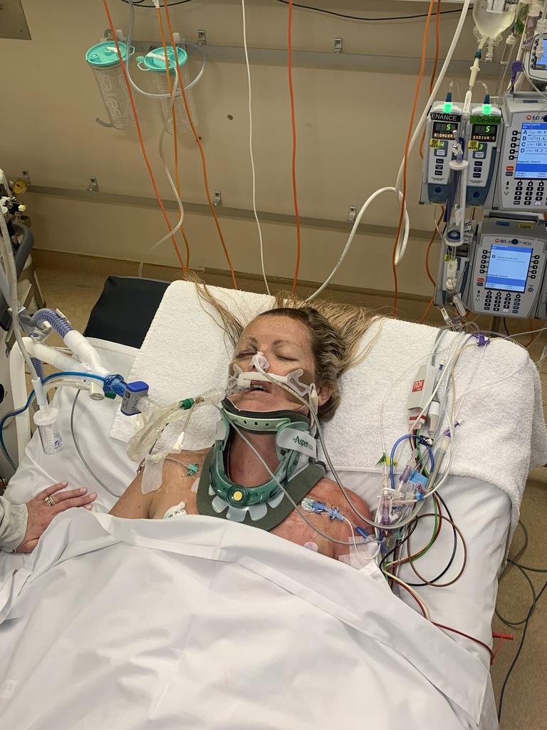Friends of Peta said her recovery time frame is unclear.
