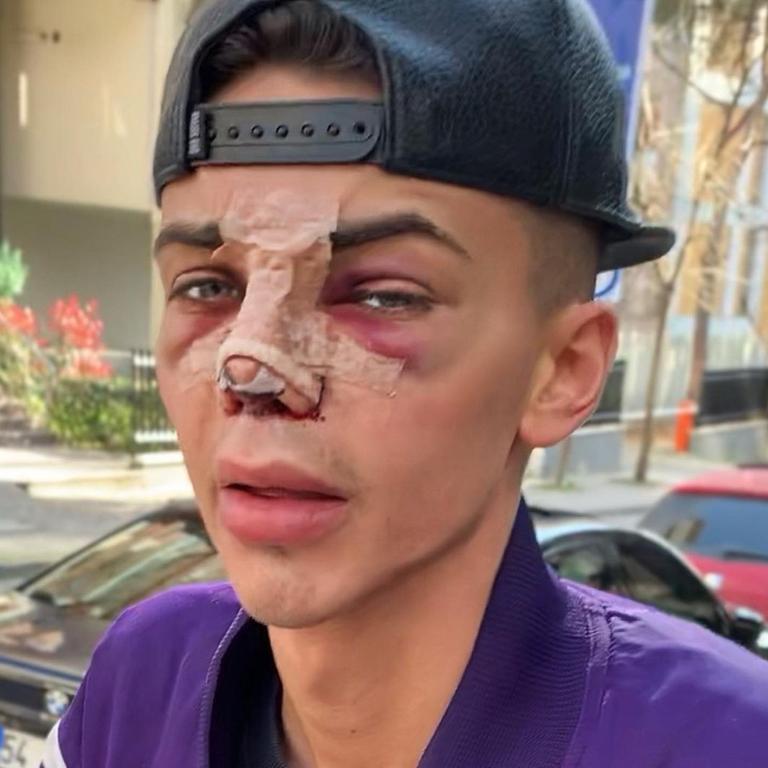 Influencer Levi Jed Murphy says his face is to The Purge mask | news.com.au Australia's leading news site