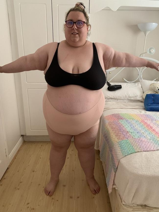 Martha McCarthy before her surgery and weight loss. Picture: SWNS