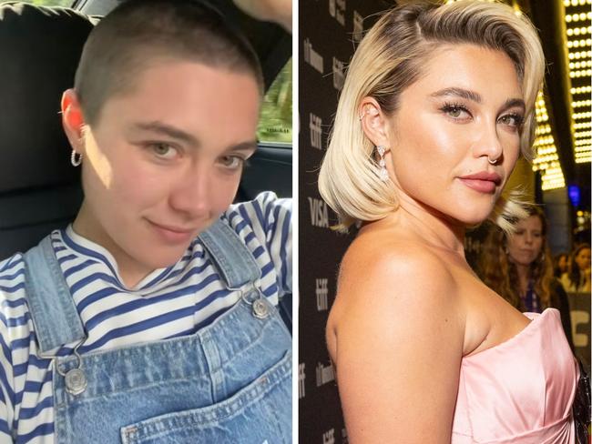 Florence Pugh has opened up about her health diagnosis for the first time.