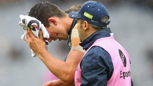 Jacob Weitering suffered a nasty head clash. Picture: Getty Images