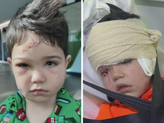 Boy’s face split open in horror dog attack