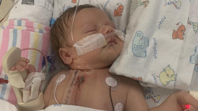 Little Archie is doing well after open heart surgery at just seven days old.