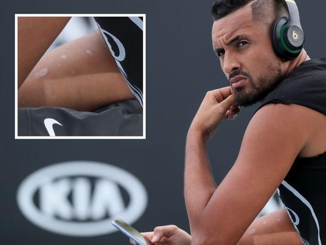 Tragic detail in Kyrgios’ Aus Open photo