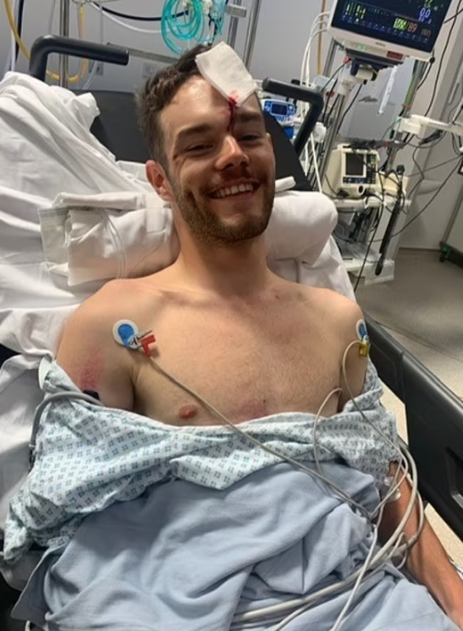 Matt Walls gets over his headache after being catapulted into the crowd at the velodrome.