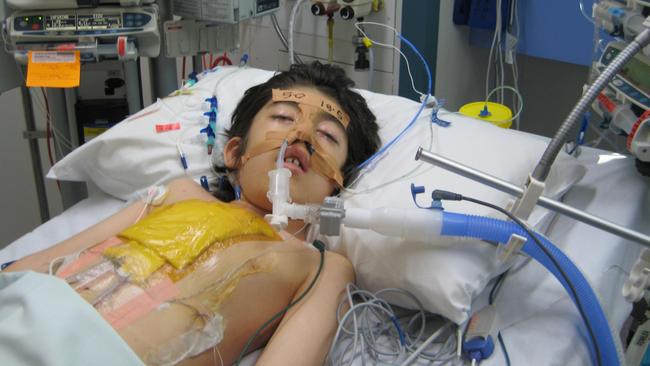 Hugo Bouhaniche recovers from cardiac surgery at Sydney Children’s Hospital, Randwick