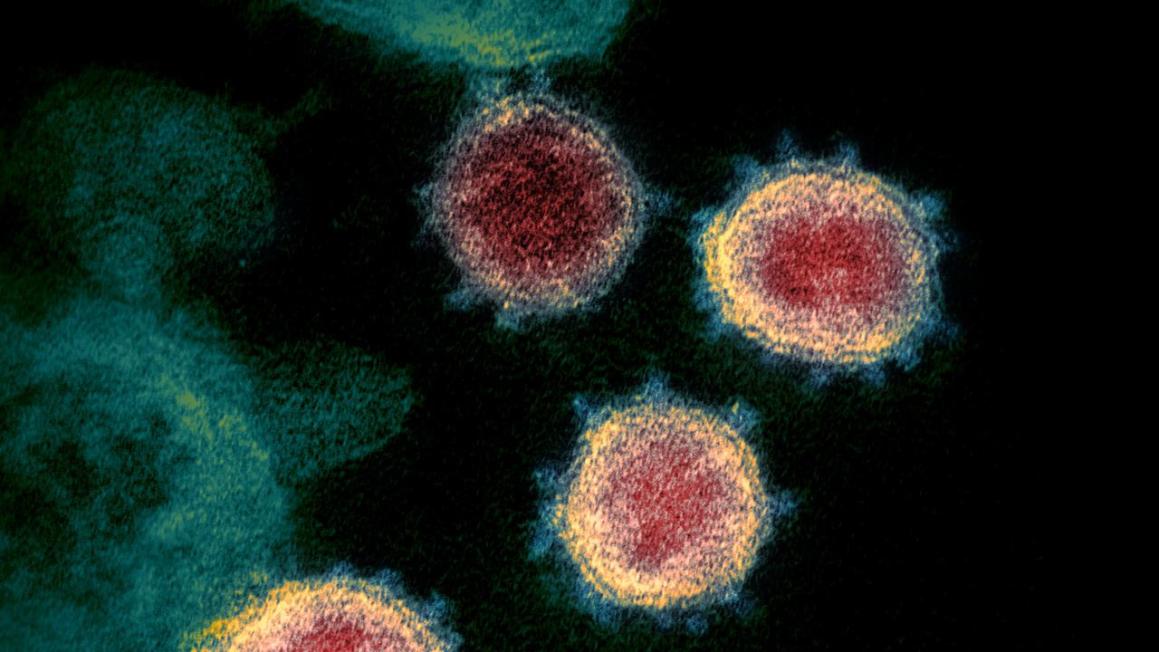 Some patients are taking up to six weeks to recover from the virus according to NSW Health. Picture: NIAID-RML via AP