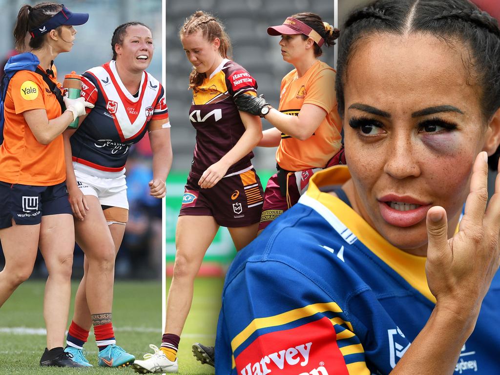 Rugby league; effects of concussion on NRL and NRLW players