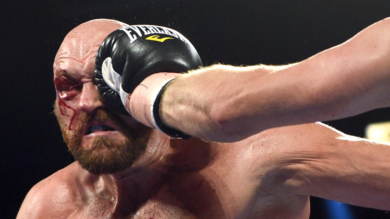 Tyson Fury. (Photo by David Becker/Getty Images)