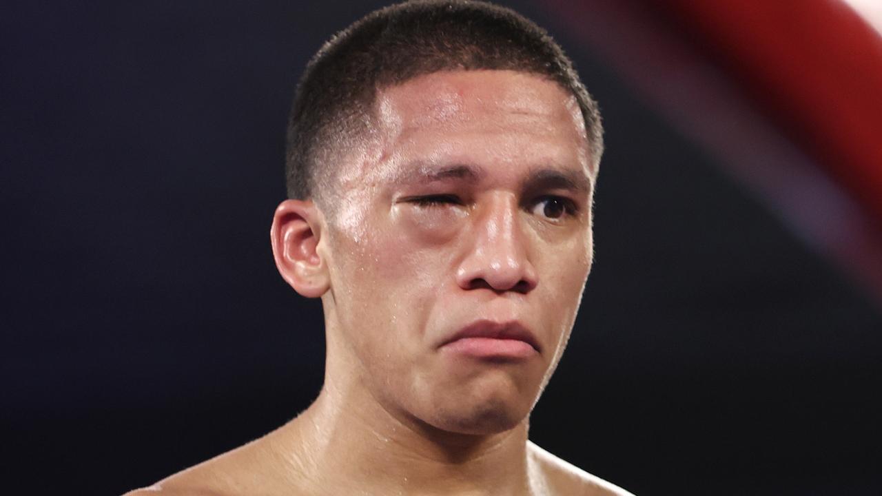 The swollen eye of Joshua Franco scaused plenty of conjecture.