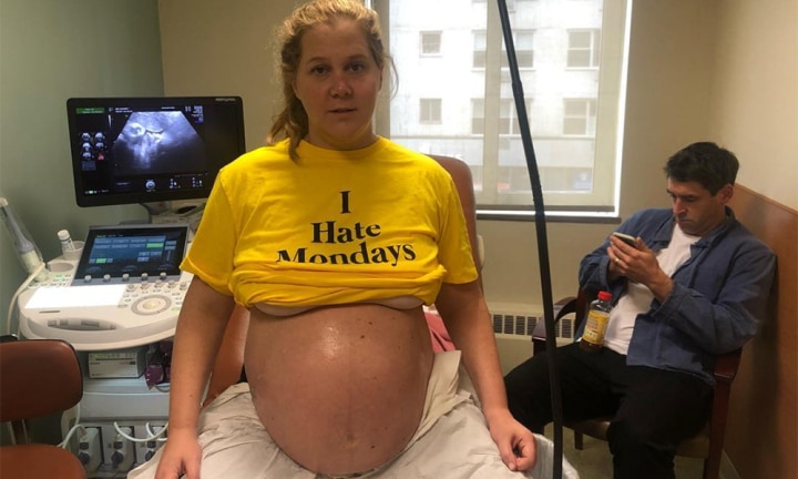 720px x 432px - Amy Schumer is every mum's spirit animal in honest breast pumping photo |  Kidspot