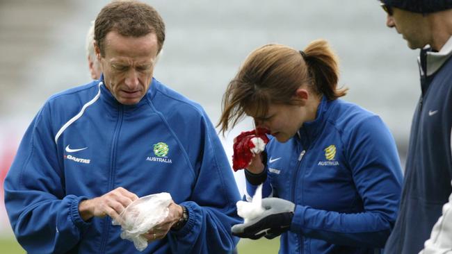 Di Alagich moments after breaking her nose during a Matildas training session the day before the Asian Cup opener in 2006. PHOTO: Supplied