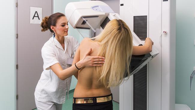 Breast cancer remained the biggest cancer killer of Gold Coast women. Picture: iStock