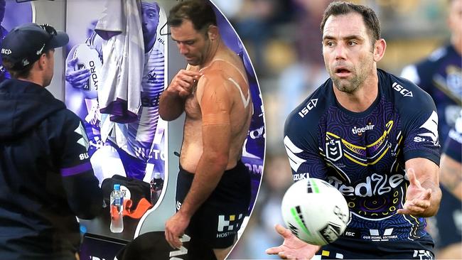 Injured Melbourne Storm captain Cameron Smith.