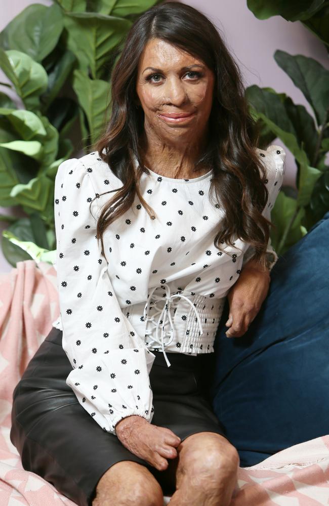 Turia Pitt created @spendwiththem to held rebuild her local community. Picture: AAP.