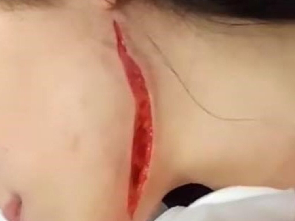 A 16-year-old girl was cut from ear to chin with a box cutter during a brawl at Kawana Shoppingworld on Monday.