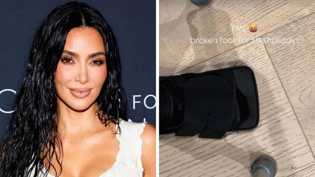 Kim Kardashian has a broken foot.