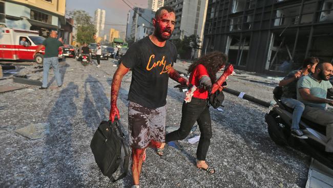 Wounded people walk away from the site of the Beirut explosion. Picture: AFP