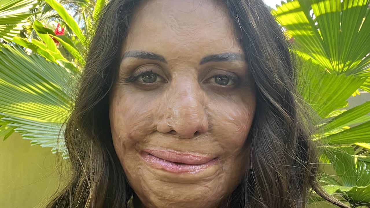 ‘I’m worthy’: Burns survivor Turia Pitt shares inspirational message
