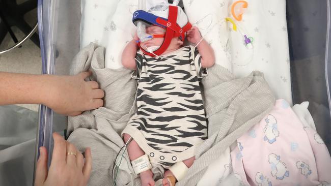 Evelyn Moss was born weighing 550g on August 7. At 80 days old, she weighed 2342g. Picture: Jamie Hanson