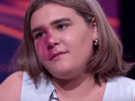 Chloe Towney told Karl Stefanovic that she would try to hide her face out in public because of her birthmark. Image: Channel 9