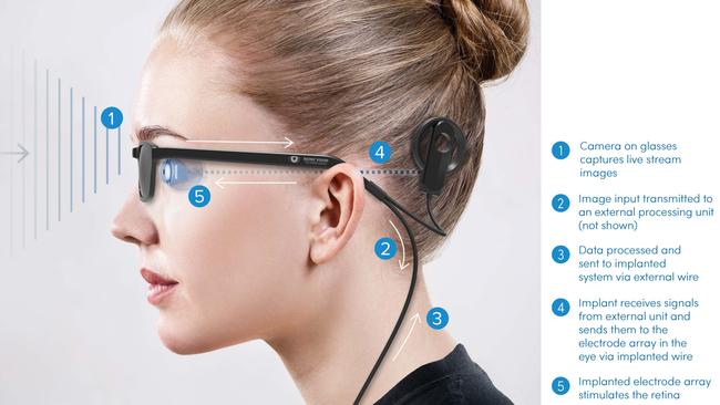 How the Bionic Eye system works.