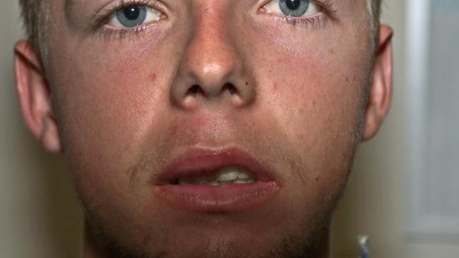Dean Webber’s doctor, Michael Likely, said forcing Mr Webber to give evidence would induce “re-traumatisation”. Photo: Supplied/QLD Police