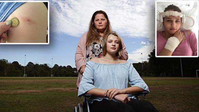 Danica McDougall with her mum and (top left) the tick bite that caused her to fall sick.