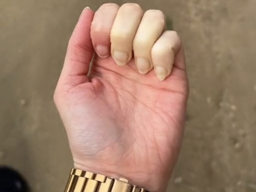 TikTok user Bella Henry says the weather has been having a bad effect on her hands.