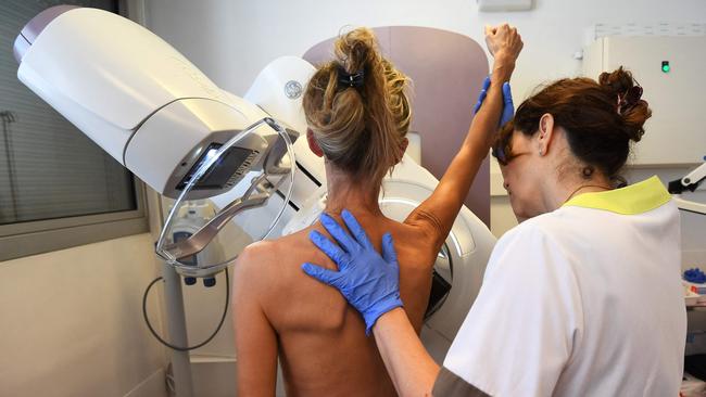 The VCR has warned there were almost 400 fewer breast cancer diagnoses in Victoria.