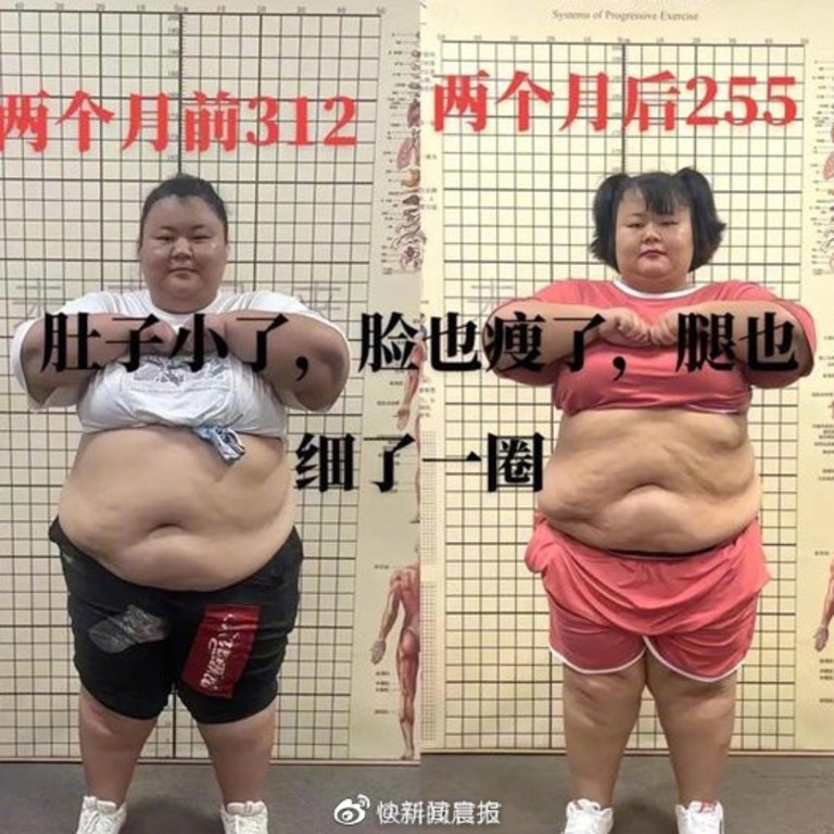 Cuihua claimed she lost 36kg in six months – of which she lost 25kg in the first two months. Picture: Weibo