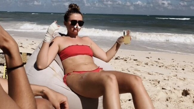 Ms Davison spent the rest of her holiday with bandaged hands. Picture: TikTok/allanaramaa