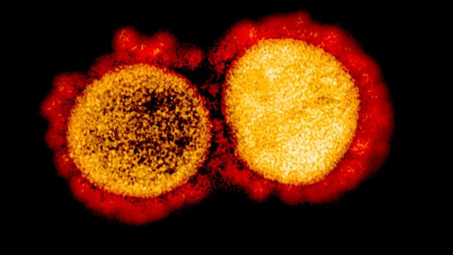 (FILES) In this file undated handout image obtained August 11, 2020, courtesy of the National Institute of Allergy and Infectious Diseases(NIH/NIAID), shows a transmission electron micrograph of SARS-CoV-2 virus particles, isolated from a patient,captured and color-enhanced at the NIAID Integrated Research Facility (IRF) in Fort Detrick, Maryland. - The US biotech firm Eli Lilly on October 7, 2020 announced it was seeking an emergency use authorization (EUA) for its lab-produced antibody treatments against Covid-19, after early trial results showed they reduced viral load, symptoms and hospitalization rates."Our teams have worked tirelessly the last seven months to discover and develop these potential antibody treatments," said Daniel Skovronsky, Lilly's chief scientific officer. (Photo by Handout / National Institute of Allergy and Infectious Diseases / AFP) / RESTRICTED TO EDITORIAL USE - MANDATORY CREDIT "AFP PHOTO /NATIONAL INSTITUTE OF ALLERGY AND INFECTIOUS DISEASES/HANDOUT " - NO MARKETING - NO ADVERTISING CAMPAIGNS - DISTRIBUTED AS A SERVICE TO CLIENTS