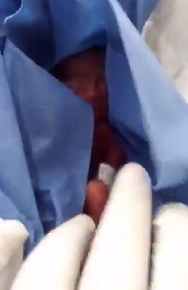 The tiny infant was born at 23 weeks. Picture: Canal 13