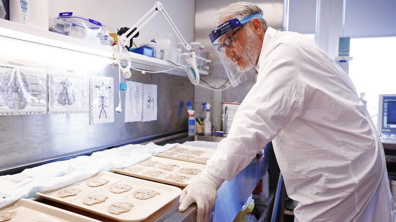 Dr Michael Buckland is Head of the Department of Neuropathology at Sydney’s Royal Prince Alfred Hospital. Picture: Sam Ruttyn