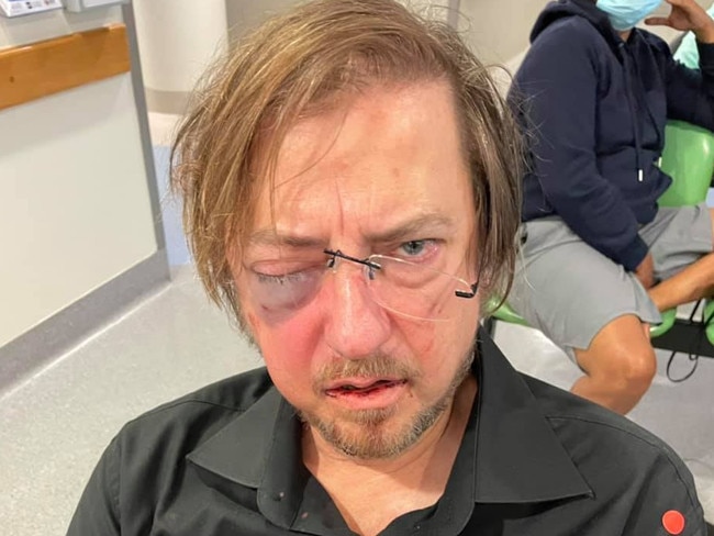 Gary Haslett. The Darwin Council alderman was viciously bashed in the Casuarina carpark in August 2021. Picture: Facebook.