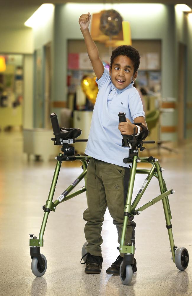 Abubakar Bakari 7, is standing on his own two feet after successful spinal surgery. Picture: David Caird