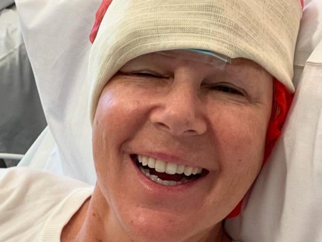 Julia Morris has skin cancer removed PICTURE: Instagram